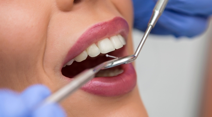 Dental-Billing-Services.webp