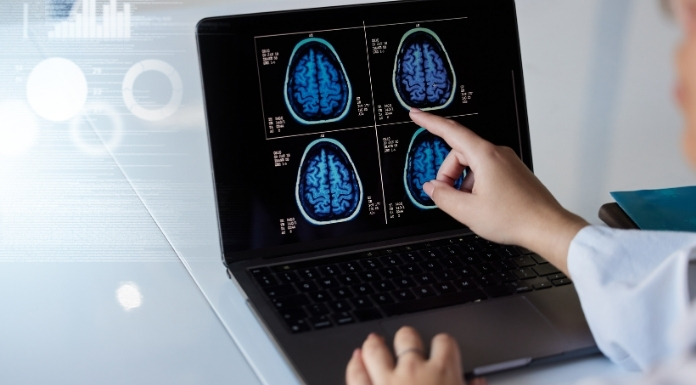 Neurology-Billing-and-Coding-Services.webp