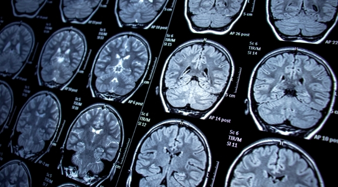 Neurology-Billing-and-Coding-Services.webp