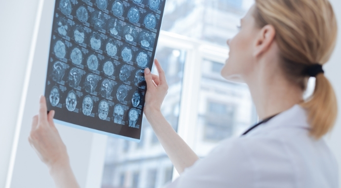 Neurology-Billing-and-Coding-Services.webp
