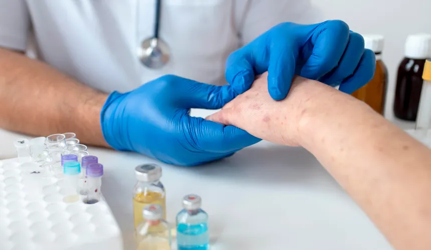 Allergy-Immunology-Billing-Service.webp