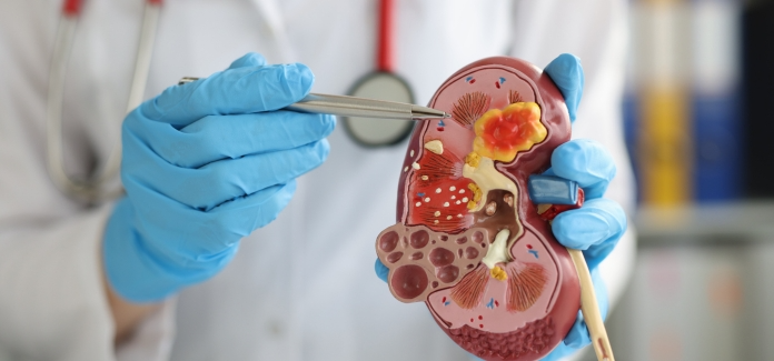 Urology-Billing-Services.webp